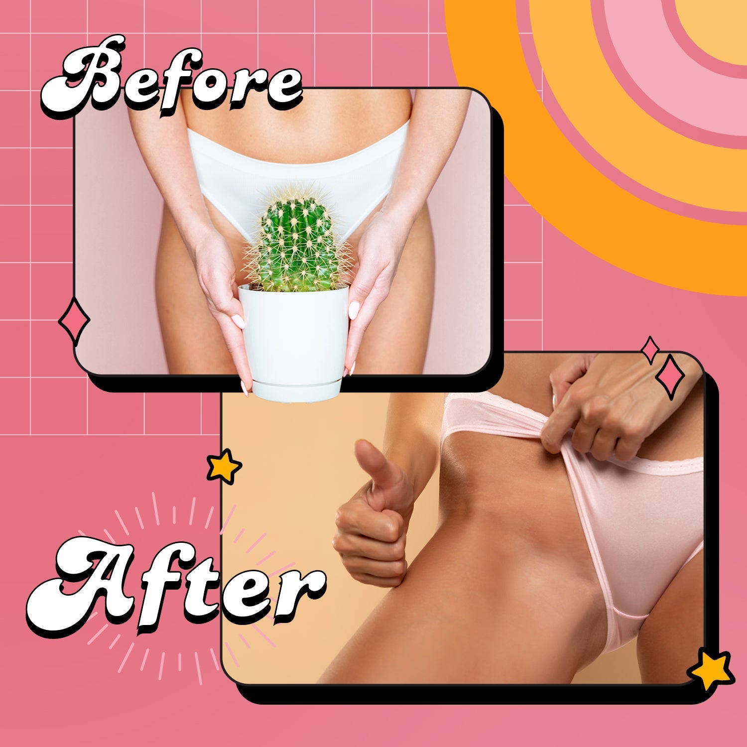 Ingrown Vulva Mask